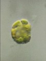 ヘテロシグマ (Heterosigma) 光学顕微鏡写真