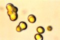ヒカリモ(ヒカリゴケ) (Ochromonas) 光学顕微鏡写真
