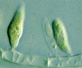 シュードカラシオプシス (Pseudocharaciopsis) 光学顕微鏡写真