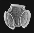 テトラパルマ (Tetraparma pelagica) 光学顕微鏡写真